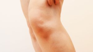 L’arthrose du genou gauche : qu’est-ce que cela signifie ?